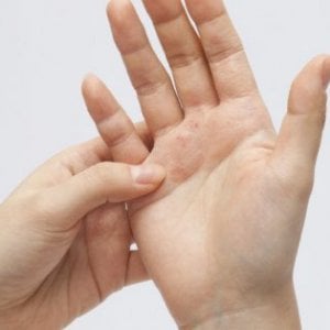Farmacia 3.0 – psoriasi, i consigli per l’estate