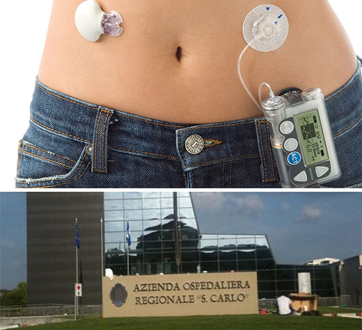 pancrea artificiale potenza ev
