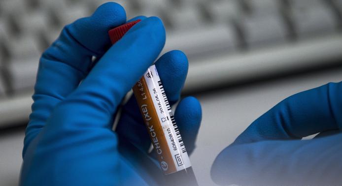 antidoping
