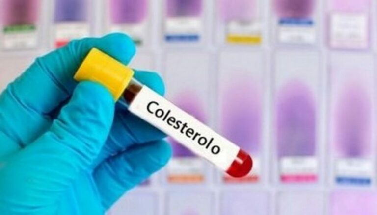 Farmacia 3.0 – come curare l’ipercolesterolemia con le piante