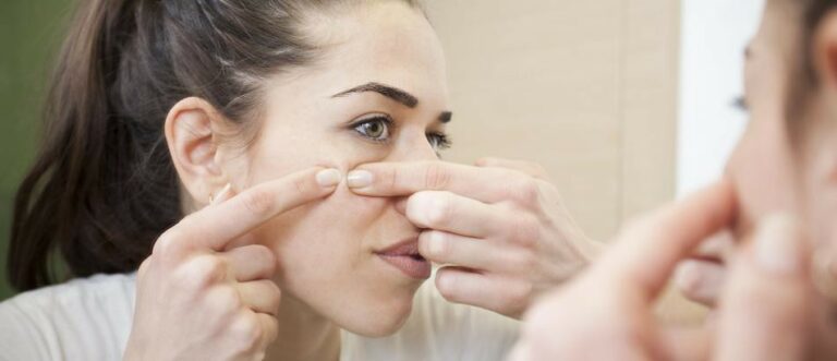 Farmacia 3.0 – i rimedi omeopatici contro l’acne