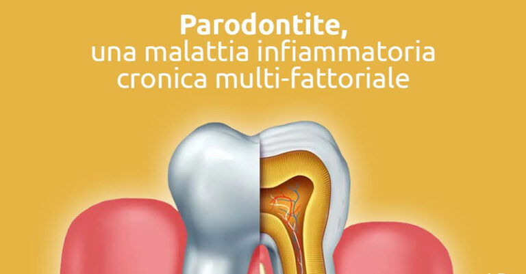 fb parodontite studio innamorato